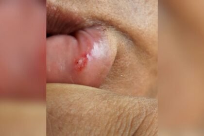 “Ela disse não e foi agredida”: caso de violência choca Dourados e levanta alerta sobre direitos das mulheres