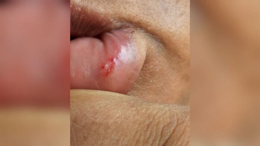 “Ela disse não e foi agredida”: caso de violência choca Dourados e levanta alerta sobre direitos das mulheres